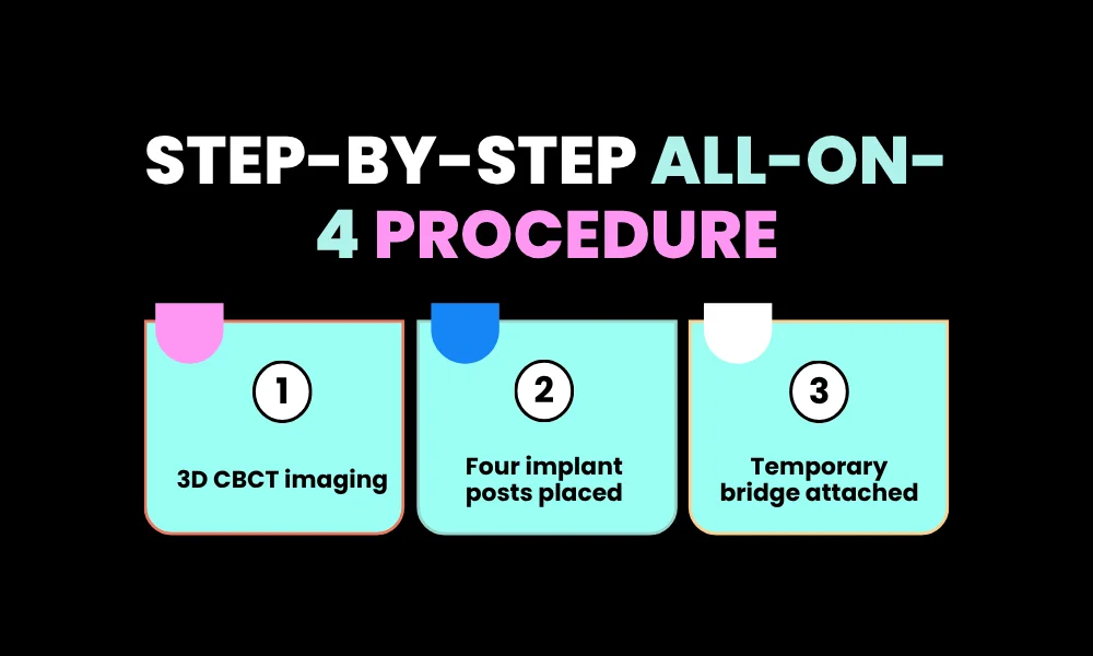 Facezem | All-on-4 Dental Implants in 2026: Cost, Procedure, Recovery & Long-Term Results Step-by-Step All-on-4 Procedure